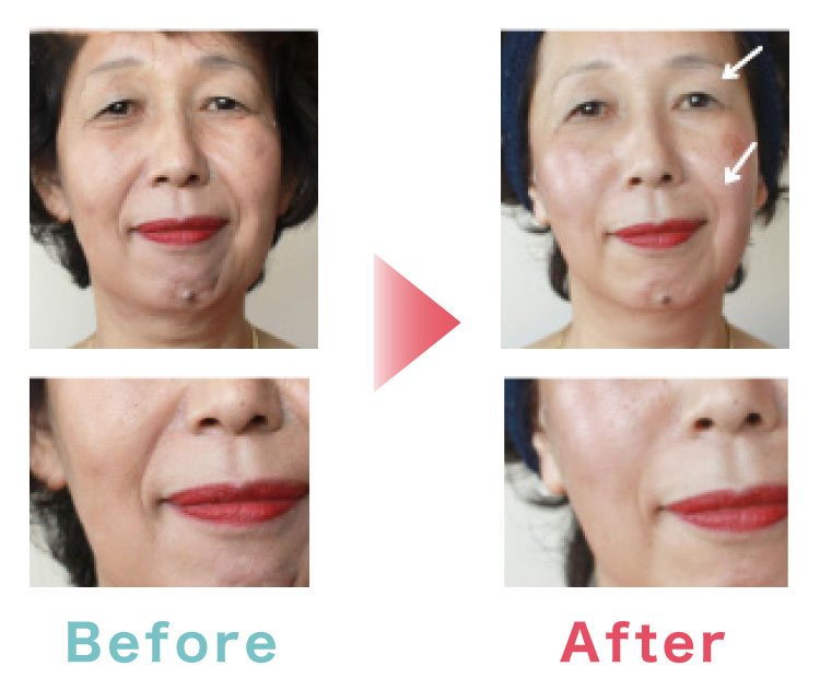 60代 フェイシャル