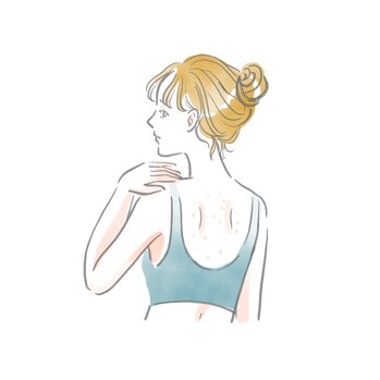 背中の肌悩みに